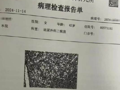 “十年体检无恙，女子再发声揭示癌症早期症状识别的重要性”